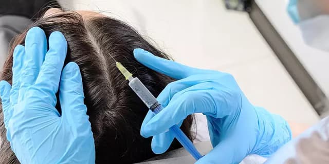 Hair & Scalp Disorders
